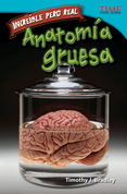 Increíble pero real: Anatomía gruesa